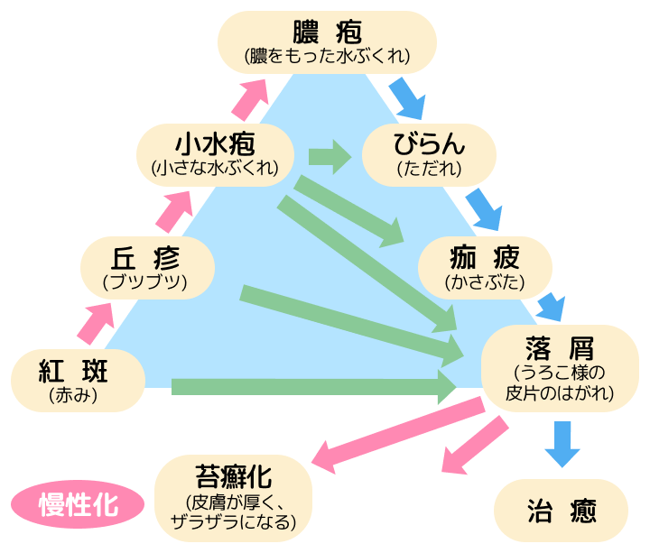 かぶれ・湿疹の経過