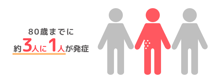 80 歳までに3人に1人が発症する