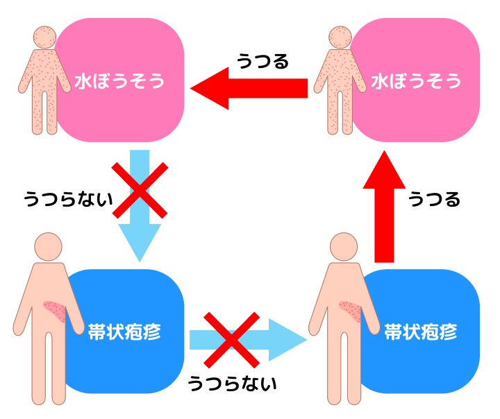 帯状疱疹は感染する？